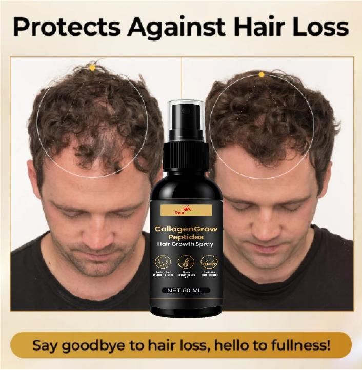 Collagen Hair Growth Spray – Hair Restore Formula (Pack of 2)