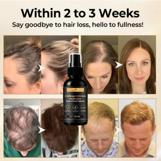 Collagen Hair Growth Spray – Hair Restore Formula (Pack of 2)